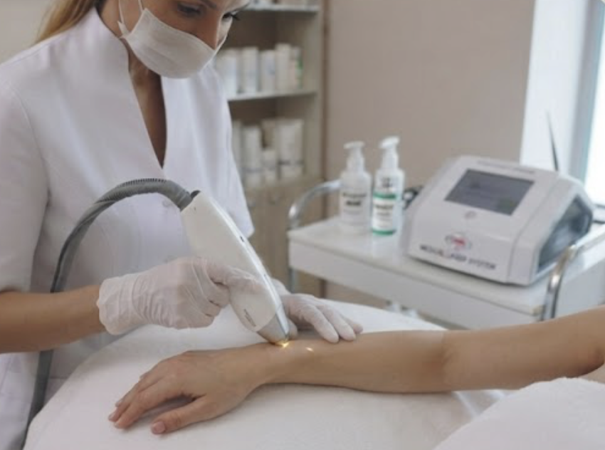 Medizinische Laser-Haarentfernung